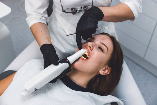 Best Knocked-Out Tooth (Avulsed Tooth) Treatment in USA